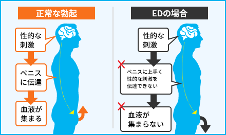 EDの説明｜EDの時と正常な勃起の違い説明